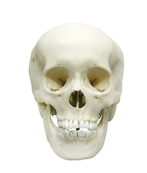 Adolescent skull ♀