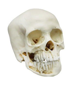 Child skull, 12 years old