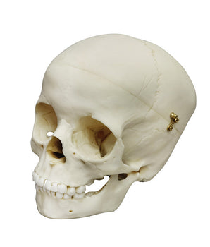Child skull, 5 years old