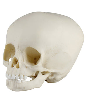 Child skull, 15 months