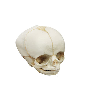 Fetal skull, 30 weeks