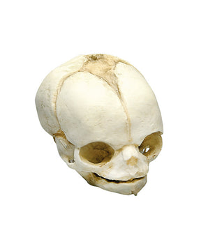 Fetal skull, 21 ½ weeks