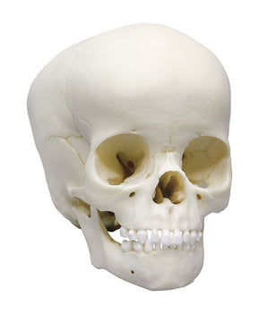 Crâne d'enfant, 4 ans