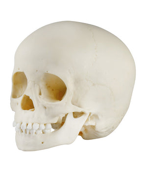 Crâne d'enfant, 3 ans