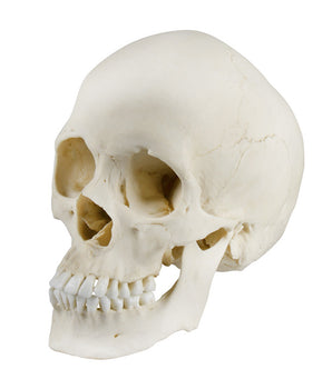 Crâne scaphocéphalique