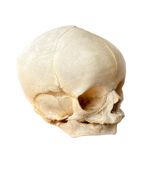 Real fetal skull 
